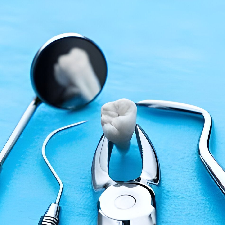 Wisdom Tooth & Tooth Extraction at Dr. Anuj Barolia's Dental Studio
