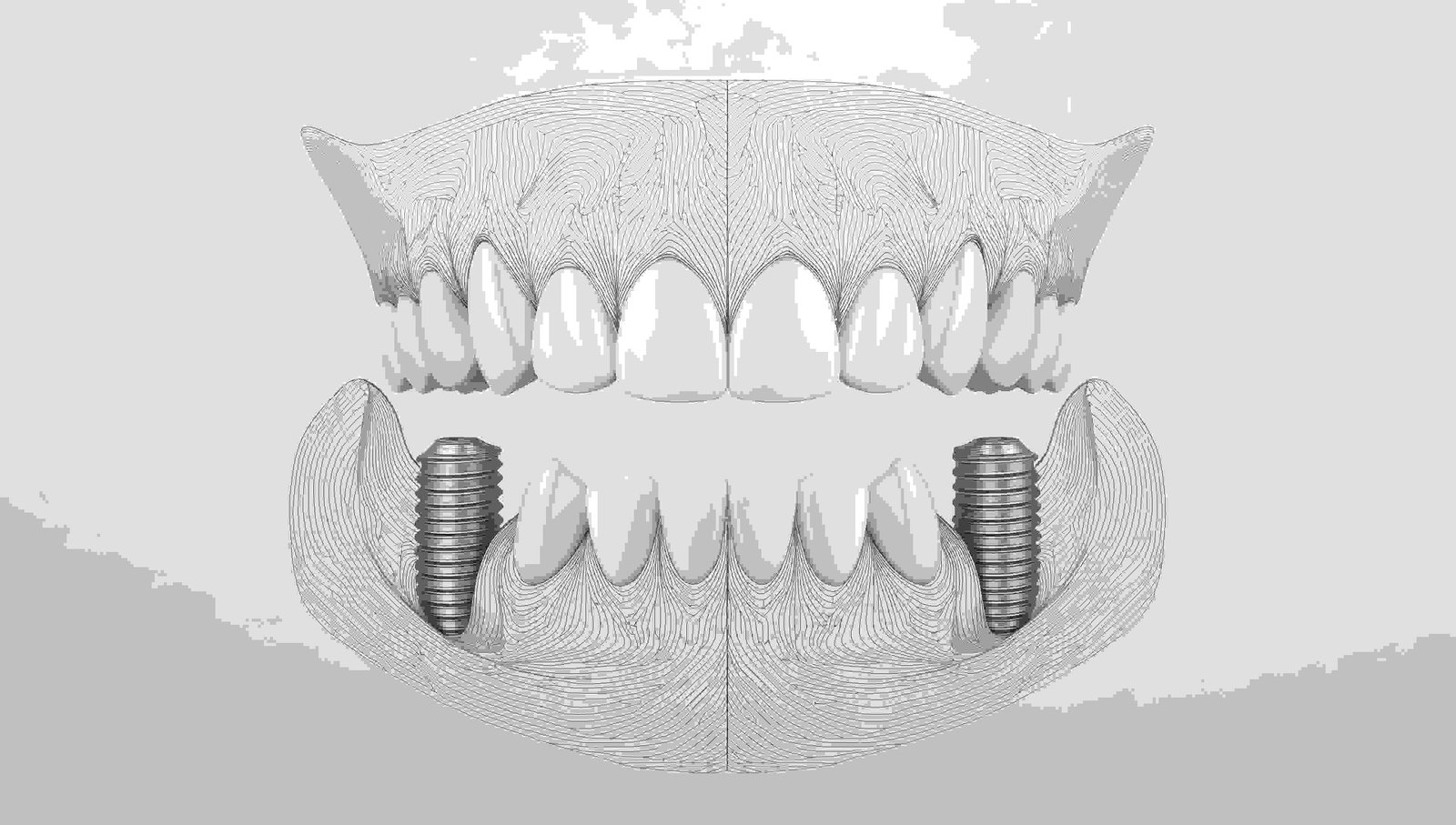 Dental Crowns & Bridges
